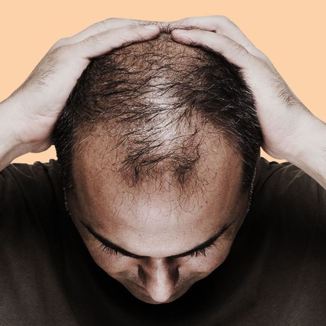 hair loss